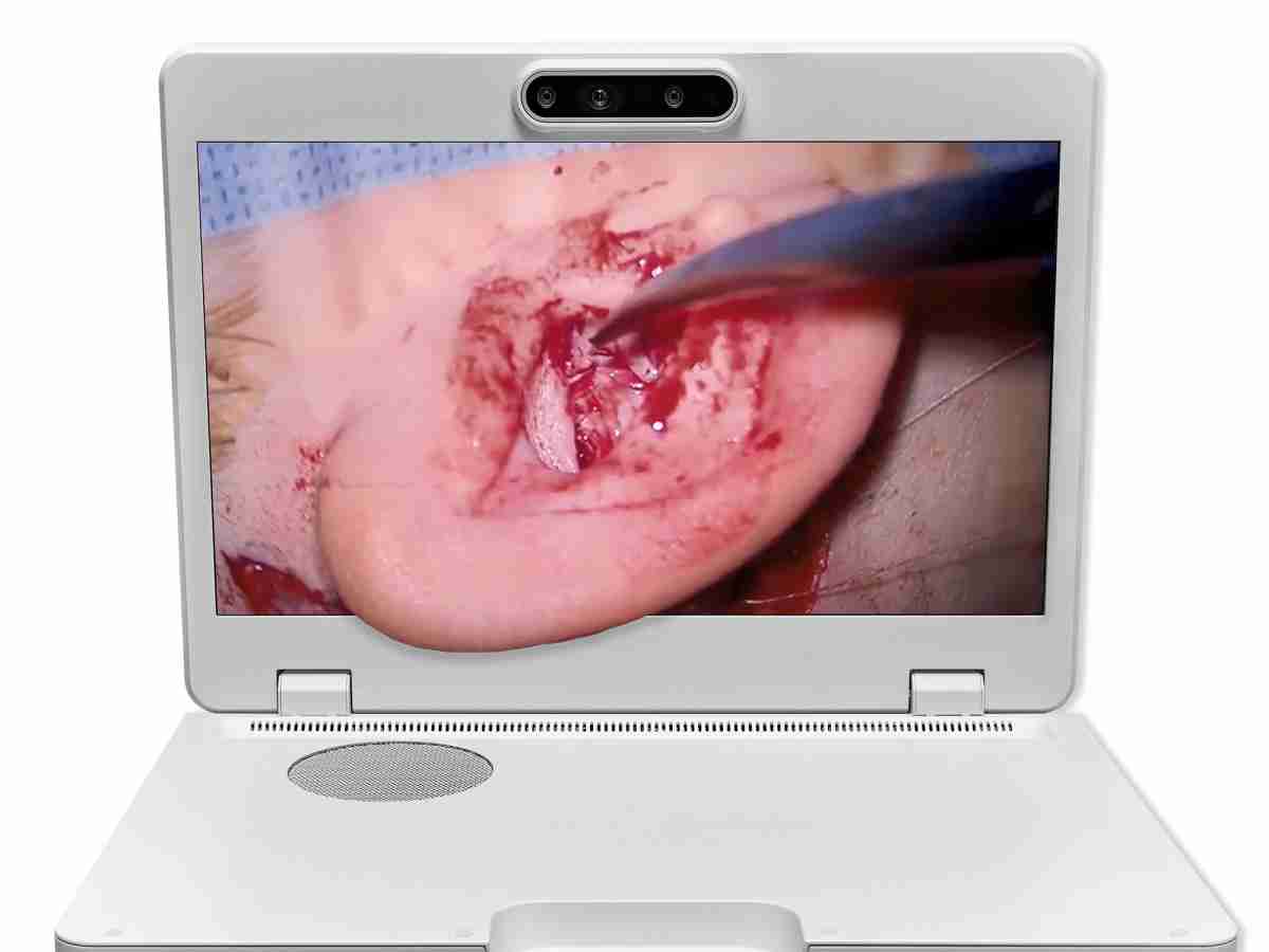 达擎之＂Heads-up 3D显微手术显示系统＂，，，整合4K裸眼3D显示及眼球追踪系统，，，具备快速追踪人眼移动位置功能，，，减轻医师长时间维持固定姿势的负担，，，让医师能有更宽广清晰的3D立体视野及更舒适的姿势来执行手术。。。。